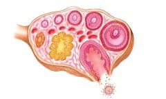 多囊卵巢可以吃葡萄吗？多囊卵巢综合症可以怀孕吗